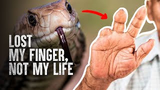 How to Survive The Most Dangerous Snake Bites  Part 2 [upl. by Mayda]