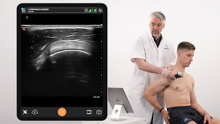 Dynamic Assessment of Ligaments of the Coracoid Process and Supraspinatus Tendon [upl. by Olli350]