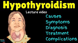 Hypothyroidism Underactive Thyroid Causes Symptoms Diagnosis Treatment Complications [upl. by Mckenna]