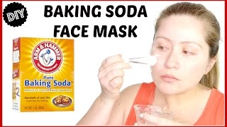 BAKING SODA FACE MASK  ACNE [upl. by Donica]