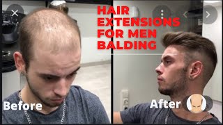 Hair Extensions For Men Balding [upl. by Baoj400]