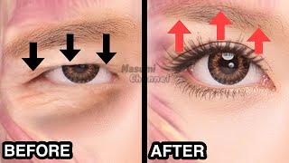 9mins Big Eyes Massage Fast Results  Lift Droopy Eyelids Make Your Eyes Bigger [upl. by Maryellen]