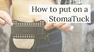 How to use the StomaTuck Ostomy accessory [upl. by Adnil]