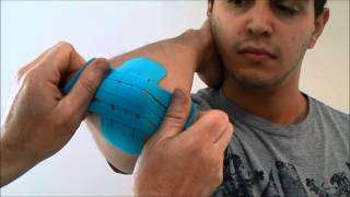 KTape Elbow Hematoma Technique [upl. by Leizar488]