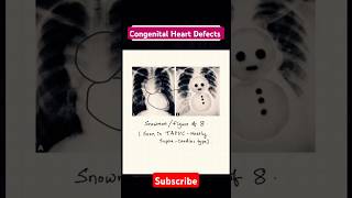 Congenital heat disease and their Characteristics shapes on radiograph heart defects neetpg [upl. by Eey]