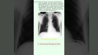 Radiology Buzz 21 radiologychannel007 [upl. by Ellemrac]