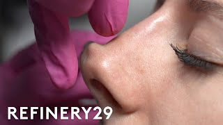 I Tried A NonSurgical Nose Job  Macro Beauty  Refinery29 [upl. by Casimir]