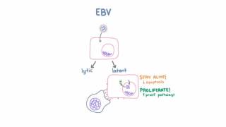 Epstein Barr Virus EBV and Cancer [upl. by Wrench]