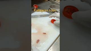 Fallopian tube biopsy sample tissuefixation tissuepreparation biopsy pathology [upl. by Hilbert49]