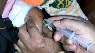 Cefepime 500mg Xemimax amp Amikasin im intramuscular injection Video 24 Ep 116 Injection Tips [upl. by Babs839]