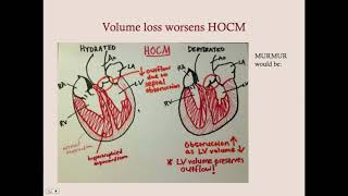 Cardiomyopathies  CRASH Medical Review Series [upl. by Ailemrac645]