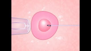 Fertilização in vitro O Passo a Passo [upl. by Ardnuaet747]