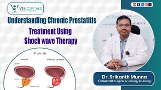 Understanding Chronic Prostatitis Treatment using Shock wave Therapy  health v9hospitals [upl. by Glanti]