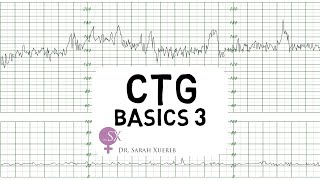 CTG Basics Part 3  Overall Assessment amp Examples [upl. by Amahs]