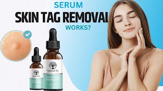 Serum Skin Tag Removal  Skinfix Skin Tag Remover [upl. by Arama]