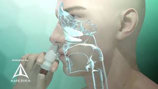 Fluticasone nasal spray Flonase  3D medical animation [upl. by Enaxor]