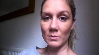 Septoplasty Recovery  Day 14 Revision Rhinoplast [upl. by Flora]