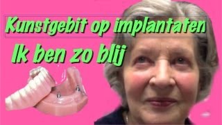 Kunstgebit op implantatenhet klikgebit gemaakt in Amsterdam Zuidoost [upl. by Salli]