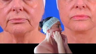 Lymphatic Drainage Massage  Lifting Sculpting Massage How To Combine 2 Massage Techniques [upl. by Lseil165]