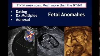 AIUM Webinar Systematic Evaluation of the 1114 Week Fetus Touching on ISUOG Guidelines [upl. by Kimmy]