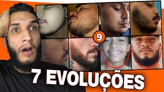 7 EVOLUÇÕES COM MINOXIDIL 9 [upl. by Nnairam]