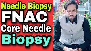 Needle Biopsy and Types  FNAC [upl. by Gayner]