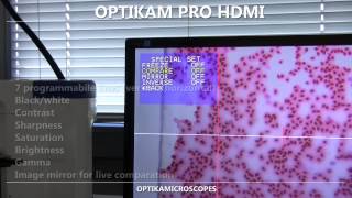 OPTIKAM PRO HDMI [upl. by Relluf]