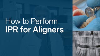 How to Perform IPR for Reveal® Clear Aligners [upl. by Suiraj]