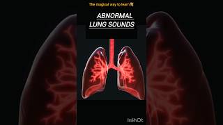 Abnormal Heart Sounds heartsoundsabnormal cardiac themagicalwaytolearn [upl. by Adnalue]