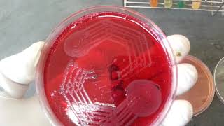 Shigella spp biochemical amp its Growth on various media [upl. by Benji71]