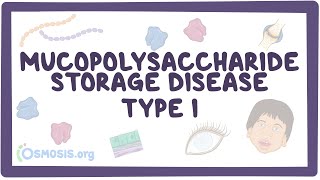 Mucopolysaccharide Storage Disease Type I Hurler HurlerScheie and Scheie syndromes [upl. by Akeemahs]