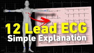 12 lead ECG  ECG interpretation made easy • Daily Cardiology [upl. by Ellicott]