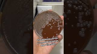 Corynebacterium y Pseudomonas putida 🧫🧫🧫🥲🧫 Bacteriologia microbiologia [upl. by Cornelius783]