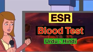 Erythrocyte Sedimentation Rate ESR Test In UrduHindi  ESR kia hota hai  ESR Test in UrduHindi [upl. by Delaney994]