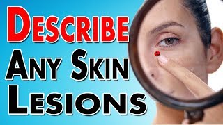 Describing Skin Lesions [upl. by Kostman]