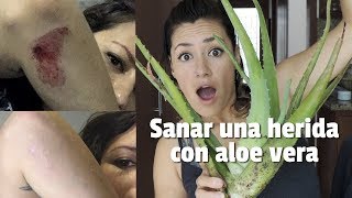 Sanar una herida de manera natural Aloe vera [upl. by Amery]