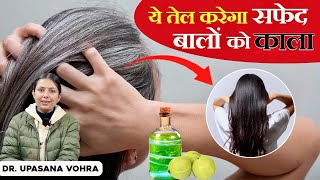 सफेद बालों को काला कैसे करें  Hair Growth Remedies  DrUpasana Vohra [upl. by Ettesyl]