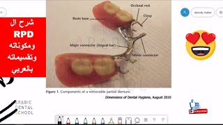 what is the rpd and classification [upl. by Ahgiel]