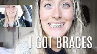 i got braces for the first time adult braces  braces at 26 [upl. by Drawyeh]