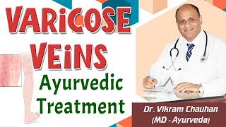 Varicose Veins Ayurvedic Treatment  Dr Vikram Chauhan [upl. by Lili844]