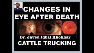 40 EYE CHAGES AFTER DEATH FIXED DILATED PUPILS TACHES NOIRES CATTLE TRUCKING OPTIC DISC [upl. by Anihcak460]