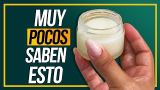 ¿Manchas y Melasma Prueba esta Crema de Papa ¡Resultados Increíbles [upl. by Zerdna981]