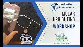 ep 25  orthodontic molar uprighting mechanics  wire bending workshop [upl. by Eetsim]