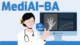 CRESCOM MediAIBA  AIPowered Software for Pediatric Bone Age Assessment [upl. by Allebasi483]