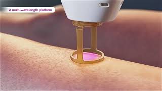 Laser hair removal  GentleMax Pro Plus 3D medical device animation [upl. by Ettenwad120]