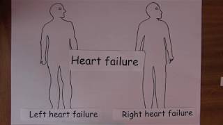 Heart Failure 7 Clinical features [upl. by Krock]