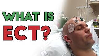 What is Electroconvulsive Therapy ECT [upl. by Zetrom33]