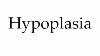 How to Pronounce Hypoplasia [upl. by Aenea]