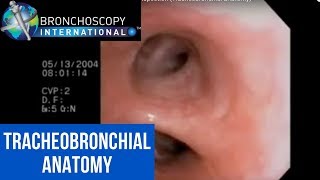 Flexible Bronchoscopy Introduction 7  Airway Inspection Tracheobronchial Anatomy [upl. by Acihsay177]