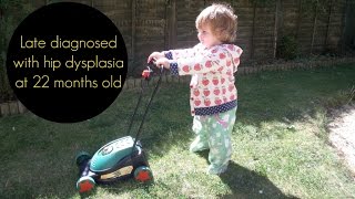 Walking pre operation for hip dysplasia correction DDH diagnosis at age 22 months [upl. by Mick]